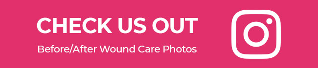 wound care instagram banner